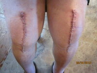 first picture of knees 001.JPG