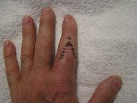 7-3-14 finger injury 005.JPG